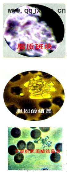 供應(yīng)麗康LK-073一滴血人體分析儀
