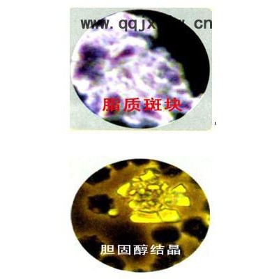 供應(yīng)麗康LK-073一滴血人體分析儀